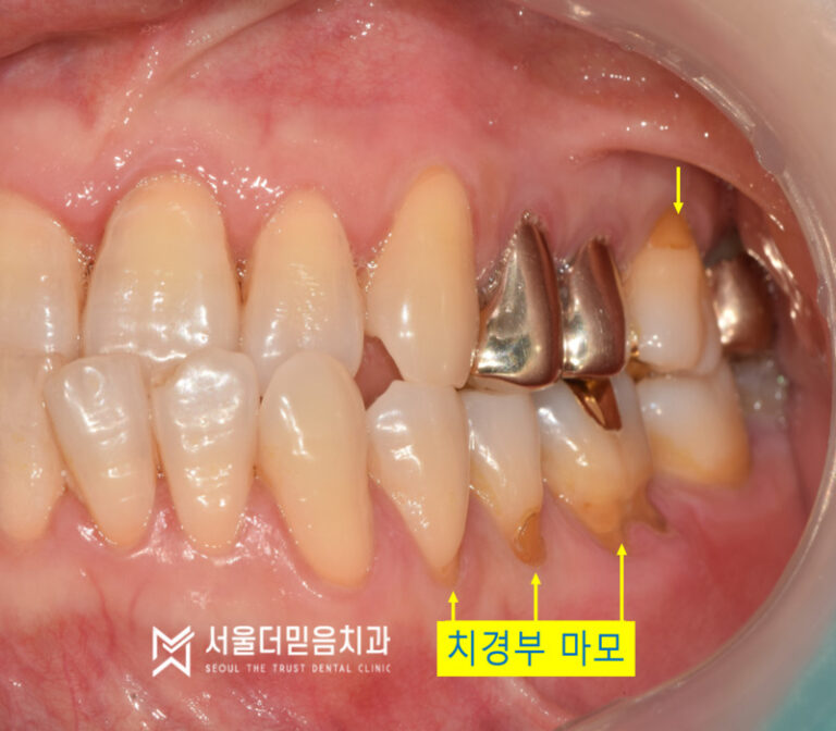 downloadImage (5)