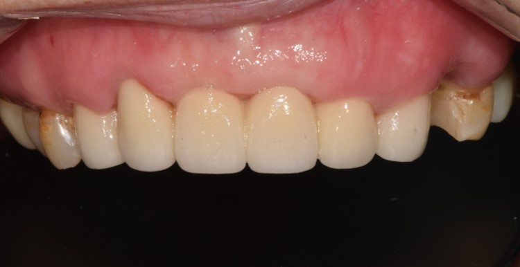 After image