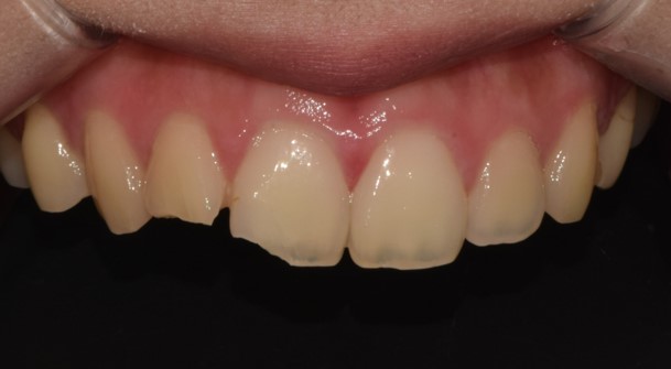 Before image