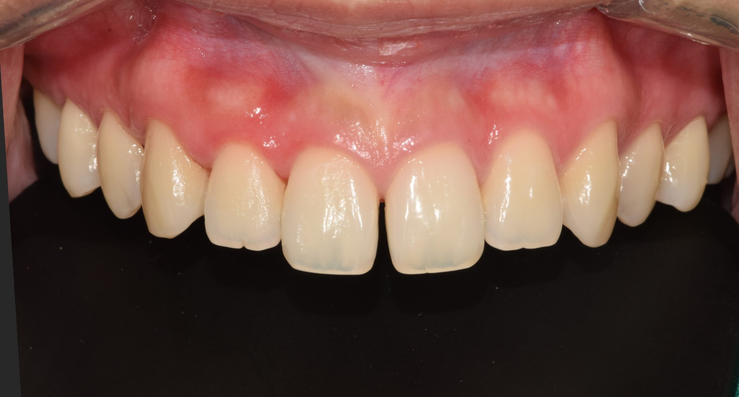Before image
