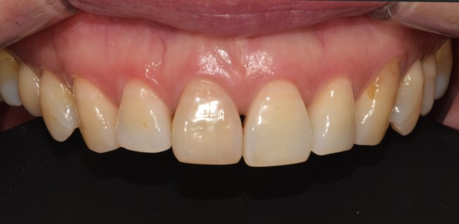 Before image
