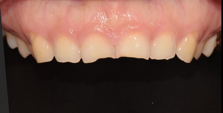 Before image