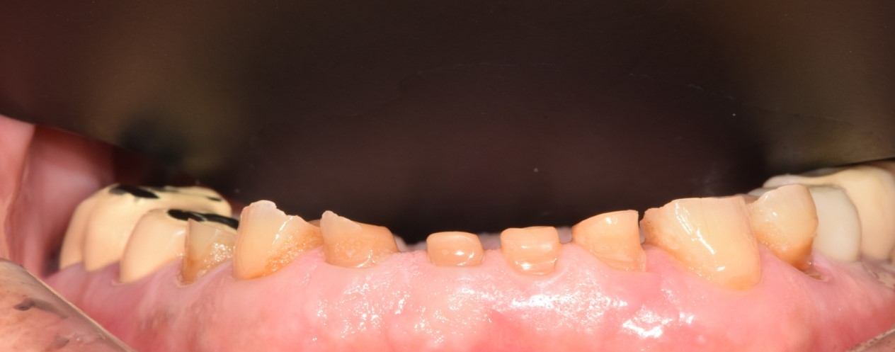 Before image